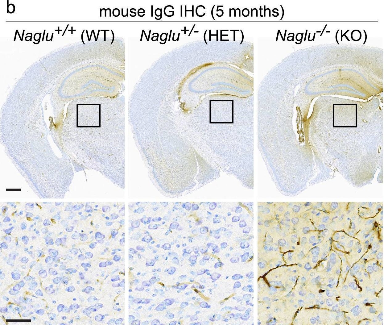 Fig.4.B showing Immunohistochemistry from the publication: Disease pathology signatures in a mouse model of Mucopolysaccharidosis type IIIB.