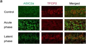 Fig.5.A showing Immunohistochemistry-immunofluorescence from the publication: Glucose Deficiency Elevates Acid-Sensing Ion Channel 2a Expression and Increases Seizure Susceptibility in Temporal Lobe Epilepsy.