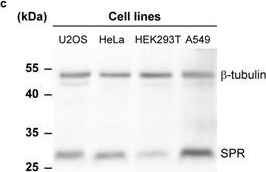 Fig.3.C showing Western Blotting from the publication: Semisynthetic biosensors for mapping cellular concentrations of nicotinamide adenine dinucleotides.