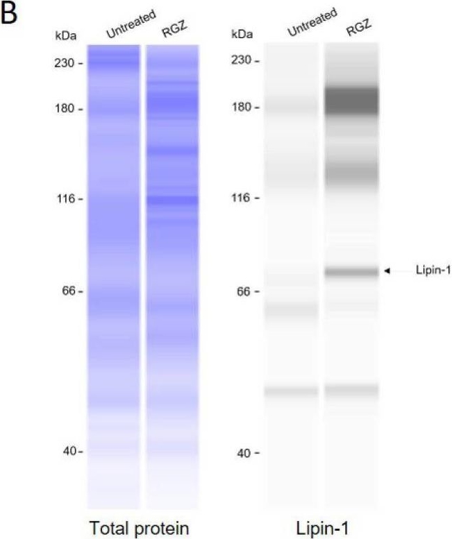 Fig.1.B showing Western Blotting from the publication: Lipin-1 Drives Browning of White Adipocytes via Promotion of Brown Phenotype Markers.