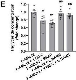 Fig.2.E from the publication: Aging-Associated Liver Sinusoidal Endothelial Cells Dysfunction Aggravates the Progression of Metabolic Dysfunction-Associated Steatotic Liver Disease.