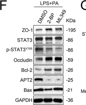 Fig.6.F showing Western Blotting from the publication: Dietary long-chain fatty acids promote colitis by regulating palmitoylation of STAT3 through CD36-mediated endocytosis.