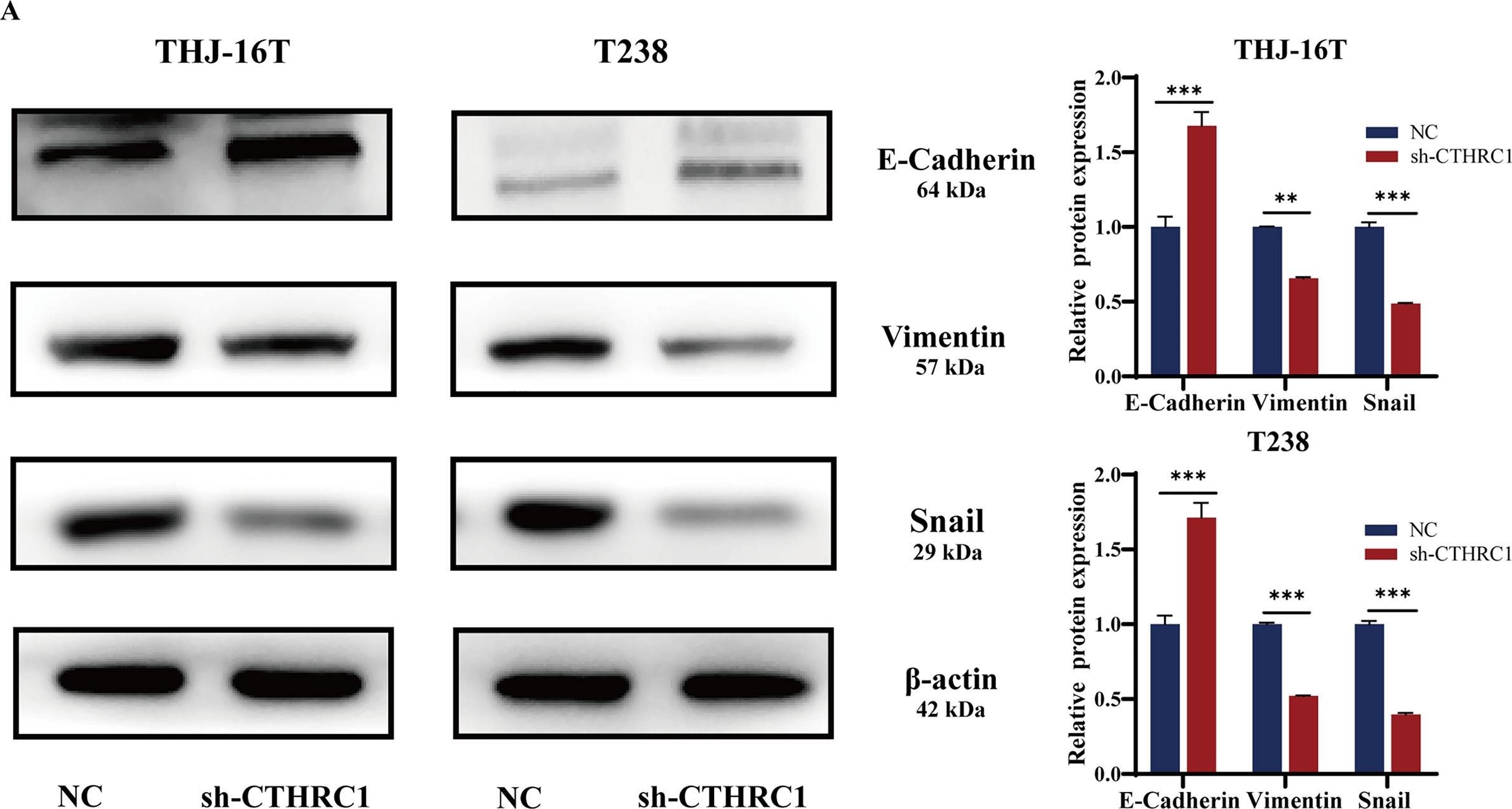 Fig.5.A showing Western Blotting from the publication: CTHRC1 promotes anaplastic thyroid cancer progression by upregulating the proliferation, migration, and invasion of tumor cells.