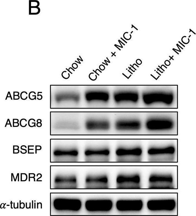 Fig.5.B showing Western Blotting in a Mus musculus (House mouse) sample from the publication: Macrophage inhibitory cytokine-1 aggravates diet-induced gallstone formation via increased ABCG5/ABCG8 expression.