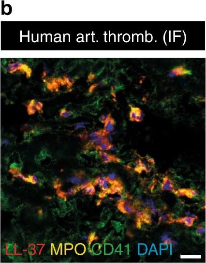 Fig.1.B showing Immunohistochemistry-frozen immunofluorescence in a Mus musculus (House mouse) sample from the publication: Cathelicidins prime platelets to mediate arterial thrombosis and tissue inflammation.