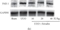 Fig.3.B showing Western Blotting in a Rattus norvegicus (Rat) sample from the publication: Hirudin Ameliorates Renal Interstitial Fibrosis via Regulating TGF-β1/Smad and NF-κB Signaling in UUO Rat Model.