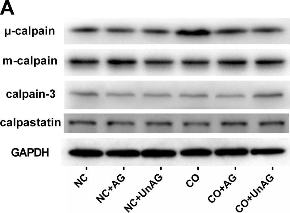 CAPN2 Antibodies - Antibody Search Engine - CiteAb