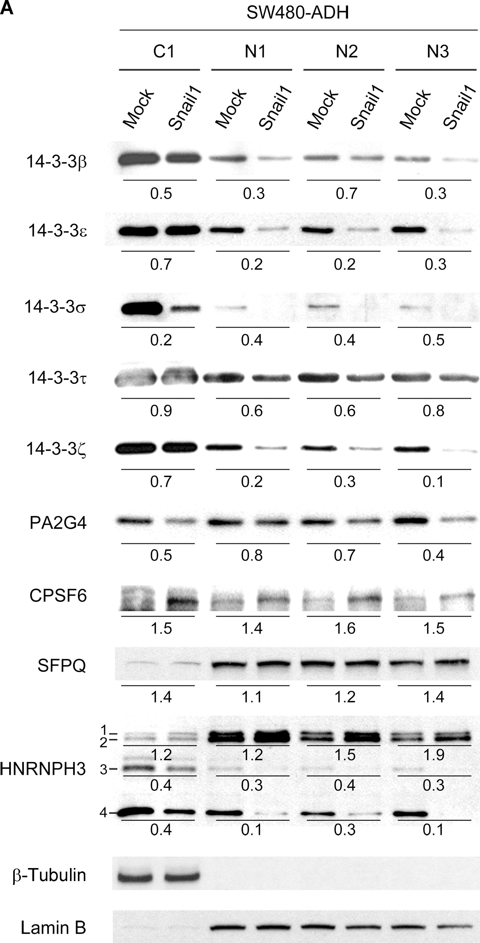 Fig.3.A showing Western Blotting in a Homo sapiens (Human) sample from the publication: Novel snail1 target proteins in human colon cancer identified by proteomic analysis.
