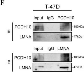Fig.6.F showing Western Blotting in a Homo sapiens (Human) sample from the publication: Classic Protocadherin PCDH10 Functions as a Tumor Suppressive Scaffold Protein Antagonizing Oncogenic WNT/β-catenin Signaling in Breast Carcinogenesis.