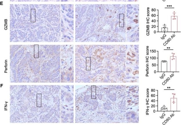 Fig.7.E showing Immunohistochemistry from the publication: CD80-Mediated T-Cell Suppression by Cancer Stem-like Cells in Head and Neck Squamous Cell Carcinoma.