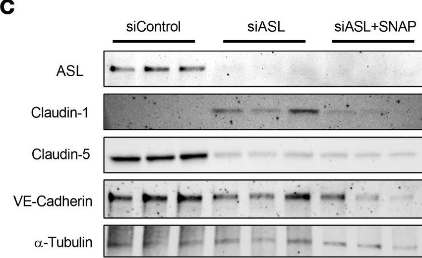 Fig.2.C showing Western Blotting from the publication: Argininosuccinate lyase deficiency causes blood-brain barrier disruption via nitric oxide-mediated dysregulation of claudin expression.