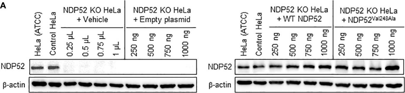 Fig.5.A showing Western Blotting in a Homo sapiens (Human) sample from the publication: Identification of autophagy receptors for the Crohn's disease-associated adherent-invasive Escherichia coli.