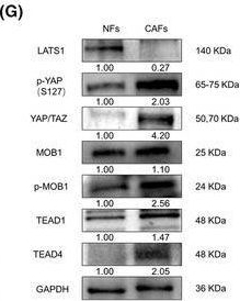 Fig.4.G showing Western Blotting from the publication: CD248-expressing cancer-associated fibroblasts induce non-small cell lung cancer metastasis via Hippo pathway-mediated extracellular matrix stiffness.