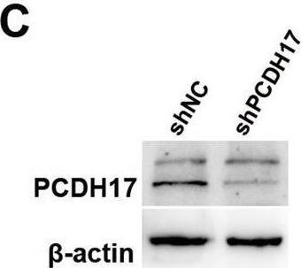 Fig.3.C showing Western Blotting in a Homo sapiens (Human) sample from the publication: PCDH17 induces colorectal cancer metastasis by destroying the vascular endothelial barrier.