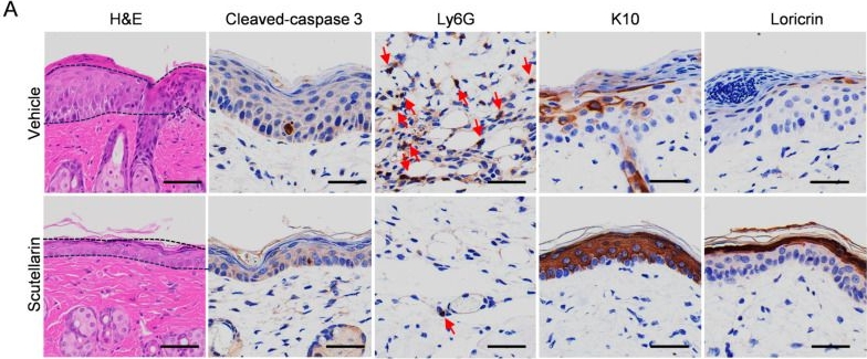 Fig.4.A showing Immunohistochemistry in a Mus musculus (House mouse) sample from the publication: Scutellarein Protects Against UVB-Induced Skin Injury in a Mouse Model.