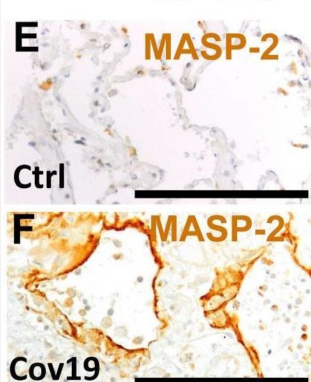 Fig.4.E showing Immunohistochemistry in a Homo sapiens (Human) sample from the publication: Complement Activation via the Lectin and Alternative Pathway in Patients With Severe COVID-19.