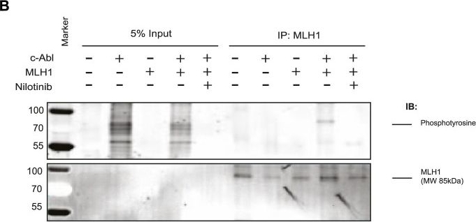 Fig.4.B showing Western Blotting from the publication: Inhibition of ABL1 by tyrosine kinase inhibitors leads to a downregulation of MLH1 by Hsp70-mediated lysosomal protein degradation.