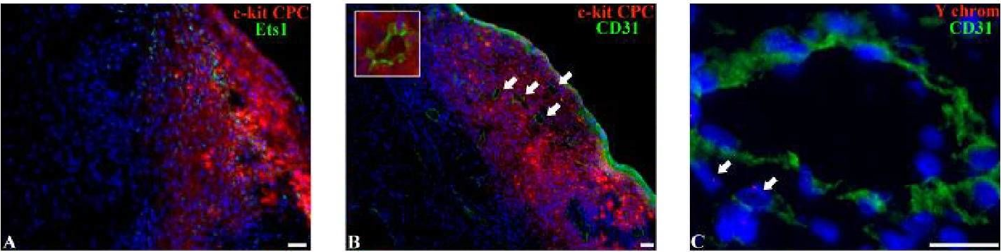 Fig.5.C showing Immunohistochemistry in a Rattus norvegicus (Rat) sample from the publication: C-Kit Cardiac Progenitor Cell Based Cell Sheet Improves Vascularization and Attenuates Cardiac Remodeling following Myocardial Infarction in Rats.