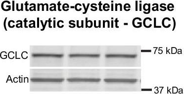 Fig.7.B showing Western Blotting in a Rattus norvegicus (Rat) sample from the publication: Metabolomic profiling reveals a differential role for hippocampal glutathione reductase in infantile memory formation.