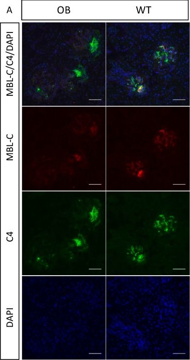 Fig.7.A showing Immunocytochemistry-immunofluorescence in a Mus musculus (House mouse) sample from the publication: Mannan-Binding Lectin Is Associated with Inflammation and Kidney Damage in a Mouse Model of Type 2 Diabetes.