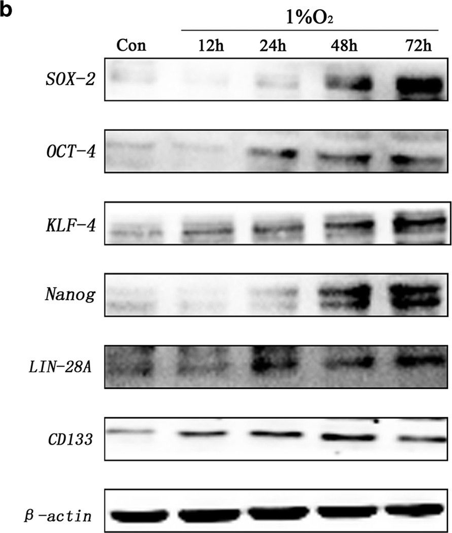 Fig.1.B showing Western Blotting in a Homo sapiens (Human) sample from the publication: Cancer stem-like cells can be induced through dedifferentiation under hypoxic conditions in glioma, hepatoma and lung cancer.
