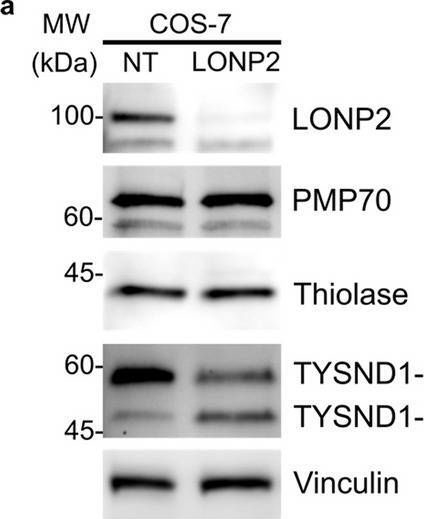 Fig.1.A showing Western Blotting from the publication: Depletion of LONP2 unmasks differential requirements for peroxisomal function between cell types and in cholesterol metabolism.