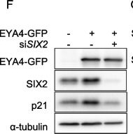 Fig.5.F showing Western Blotting in a Homo sapiens (Human) sample from the publication: EYA4 promotes cellular senescence by enhancing P21 transcription through interaction with SIX2.