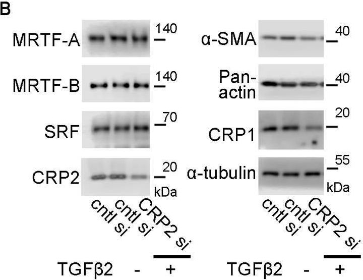 Fig.2.B showing Western Blotting from the publication: Role of CRP2-MRTF interaction in functions of myofibroblasts.