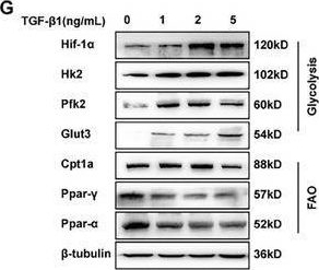 Fig.2.G showing Western Blotting in a Homo sapiens (Human) sample from the publication: Fatty Acid Oxidation-Glycolysis Metabolic Transition Affects ECM Homeostasis in Silica-Induced Pulmonary Fibrosis.