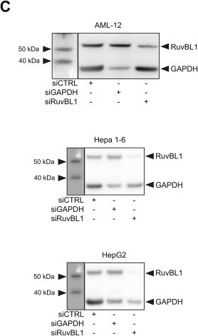Fig.2.C showing Western Blotting from the publication: Targeting RuvBL1 disrupts mitochondrial metabolism and structure in hepatocellular carcinoma.