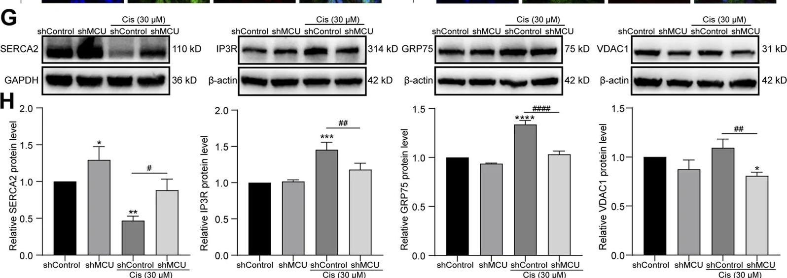 Fig.3.G showing Western Blotting from the publication: MCU knockdown attenuates cisplatin-induced damage of auditory cells: potential involvement of PI3K/AKT/mTOR signaling and autophagy-related processes.