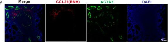 alpha-Smooth Muscle Actin (1A4) Mouse Monoclonal Antibody (IHC