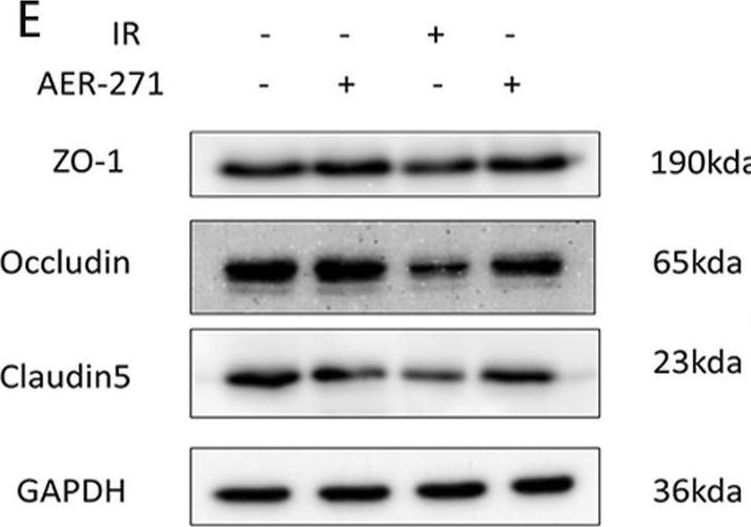 Fig.6.E showing Western Blotting from the publication: Protective effects of AER-271 in acute-phase radiation-induced brain injury in rats: reduction of brain edema, inflammation, apoptosis and maintenance of blood-brain barrier integrity.