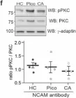 Fig.10.F showing Western Blotting from the publication: Interactions between the Polysialylated Neural Cell Adhesion Molecule and the Transient Receptor Potential Canonical Channels 1, 4, and 5 Induce Entry of Ca2+ into Neurons.