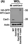 Fig.7.A showing Western Blotting from the publication: Caveolin-3 deficiency associated with the dystrophy P104L mutation impairs skeletal muscle mitochondrial form and function.