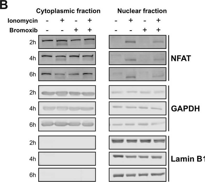 Fig.4.B showing Western Blotting in a Homo sapiens (Human) sample from the publication: The Polybrominated Diphenyl Ether Bromoxib Disrupts Nuclear Import and Export by Affecting Nucleoporins of the Nuclear Pore Complex.