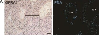 Fig.2.A showing Immunohistochemistry from the publication: The topographical distribution of spermatogonial subpopulations during the cycle of seminiferous epithelium in Macaca Fascicularis.