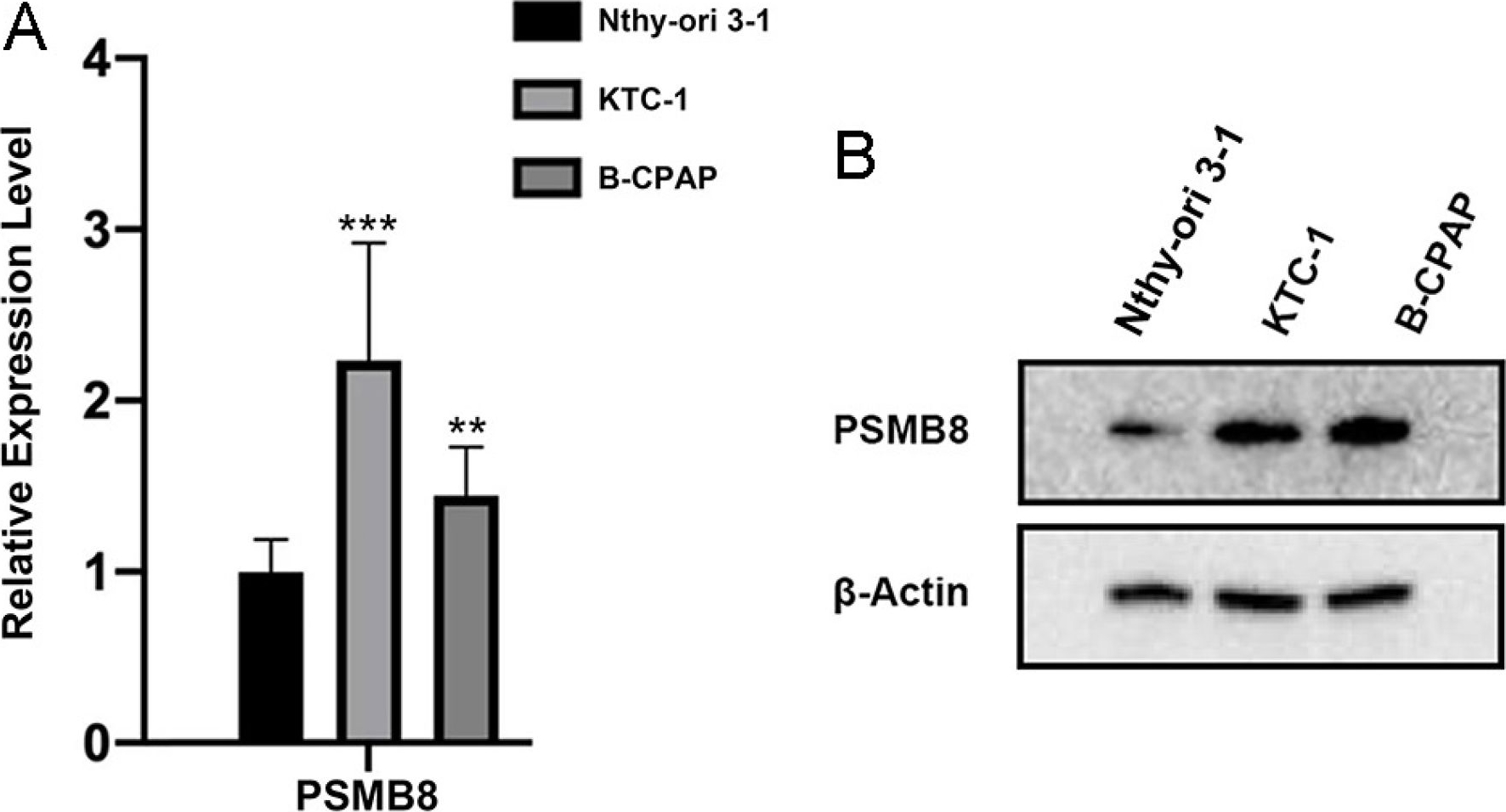Fig.9.A showing Western Blotting in a Homo sapiens (Human) sample from the publication: Multifaceted investigations of PSMB8 provides insights into prognostic prediction and immunological target in thyroid carcinoma.