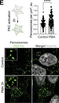 Fig.3.E showing Immunocytochemistry-immunofluorescence in a Homo sapiens (Human) sample from the publication: Protein Kinase C promotes peroxisome biogenesis and peroxisome-endoplasmic reticulum interaction.