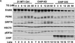 Fig.4.C showing Western Blotting in a Homo sapiens (Human) sample from the publication: CHIP/STUB1 Ubiquitin Ligase Functions as a Negative Regulator of ErbB2 by Promoting Its Early Post-Biosynthesis Degradation.
