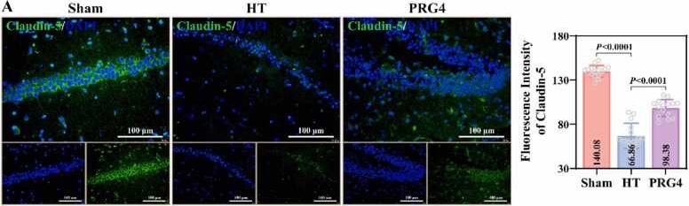 Fig.4.A showing Immunohistochemistry-immunofluorescence in a Capra aegagrus hircus (Goat) sample from the publication: Proteoglycan 4 attenuates ischemic post-stroke hemorrhagic transformation and blood-brain barrier disruption.