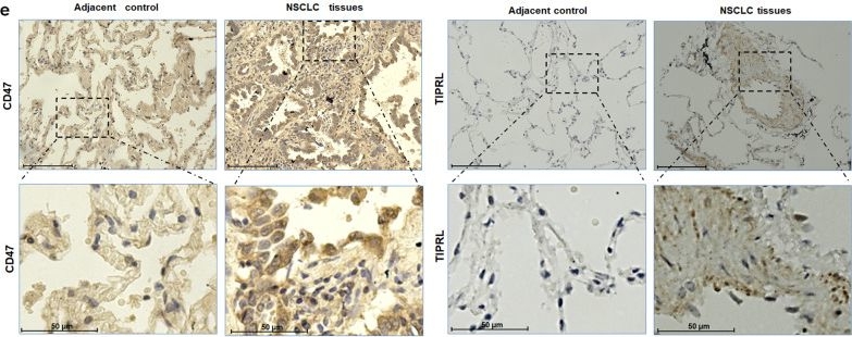 Fig.8.E showing Immunohistochemistry from the publication: m6A-methylated KCTD21-AS1 regulates macrophage phagocytosis through CD47 and cell autophagy through TIPR.