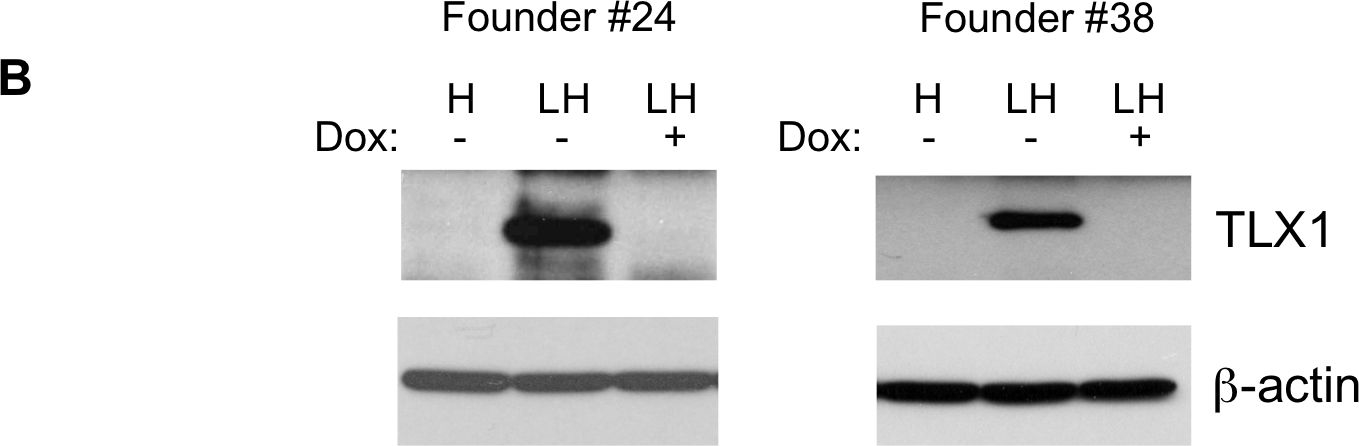 Fig.1.B showing Western Blotting in a Mus musculus (House mouse) sample from the publication: Transient responses to NOTCH and TLX1/HOX11 inhibition in T-cell acute lymphoblastic leukemia/lymphoma.