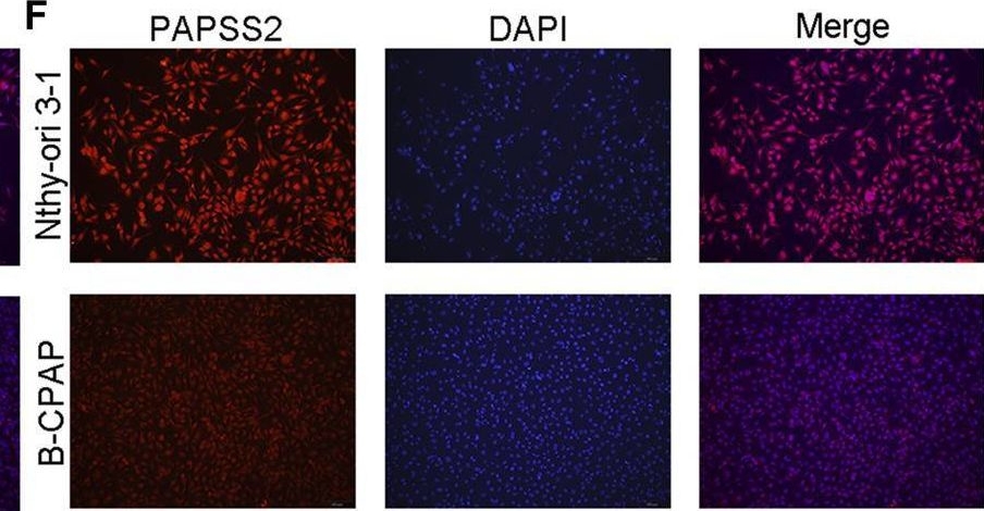 Fig.11.F showing Immunocytochemistry-immunofluorescence from the publication: A metabolism-related gene signature for predicting the prognosis in thyroid carcinoma.