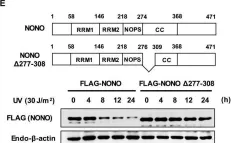 Fig.4.E showing Western Blotting from the publication: RNF8 mediates NONO degradation following UV-induced DNA damage to properly terminate ATR-CHK1 checkpoint signaling.