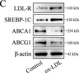 Fig.4.C showing Western Blotting from the publication: Leukocyte immunoglobulin-like receptor B2 regulates atherosclerosis progression by modulating macrophage extracellular trap formation in foam macrophages through the PI3K-AKT signaling pathway.