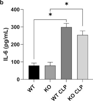 Fig.2.B showing Enzyme-linked immunosorbent assay from the publication: iRhom2 deficiency reduces sepsis-induced mortality associated with the attenuation of lung macrophages in mice.
