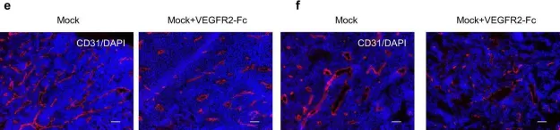 Fig.4.E showing Immunohistochemistry-immunofluorescence from the publication: Activated FGF2 signaling pathway in tumor vasculature is essential for acquired resistance to anti-VEGF therapy.