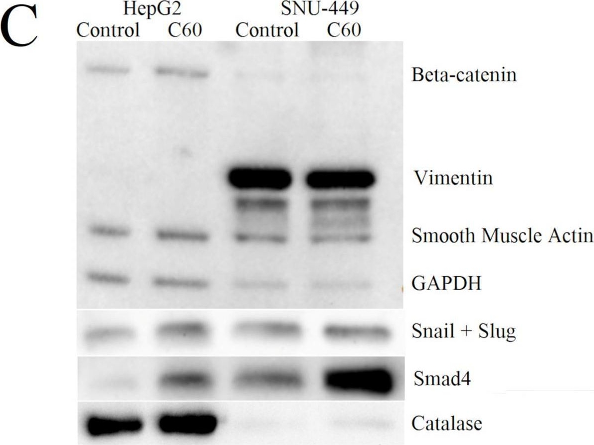 Fig.6.C showing Western Blotting in a Homo sapiens (Human) sample from the publication: Influence of C60 Nanofilm on the Expression of Selected Markers of Mesenchymal-Epithelial Transition in Hepatocellular Carcinoma.