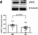 Fig.1.D showing Western Blotting in a Homo sapiens (Human) sample from the publication: Atrial Fibrillation Progression Is Associated with Cell Senescence Burden as Determined by p53 and p16 Expression.
